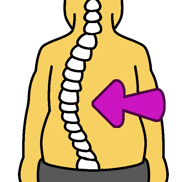 A yellow person in gray pants with a spine curving far to the left, and a pink arrow pointing into the curve.
